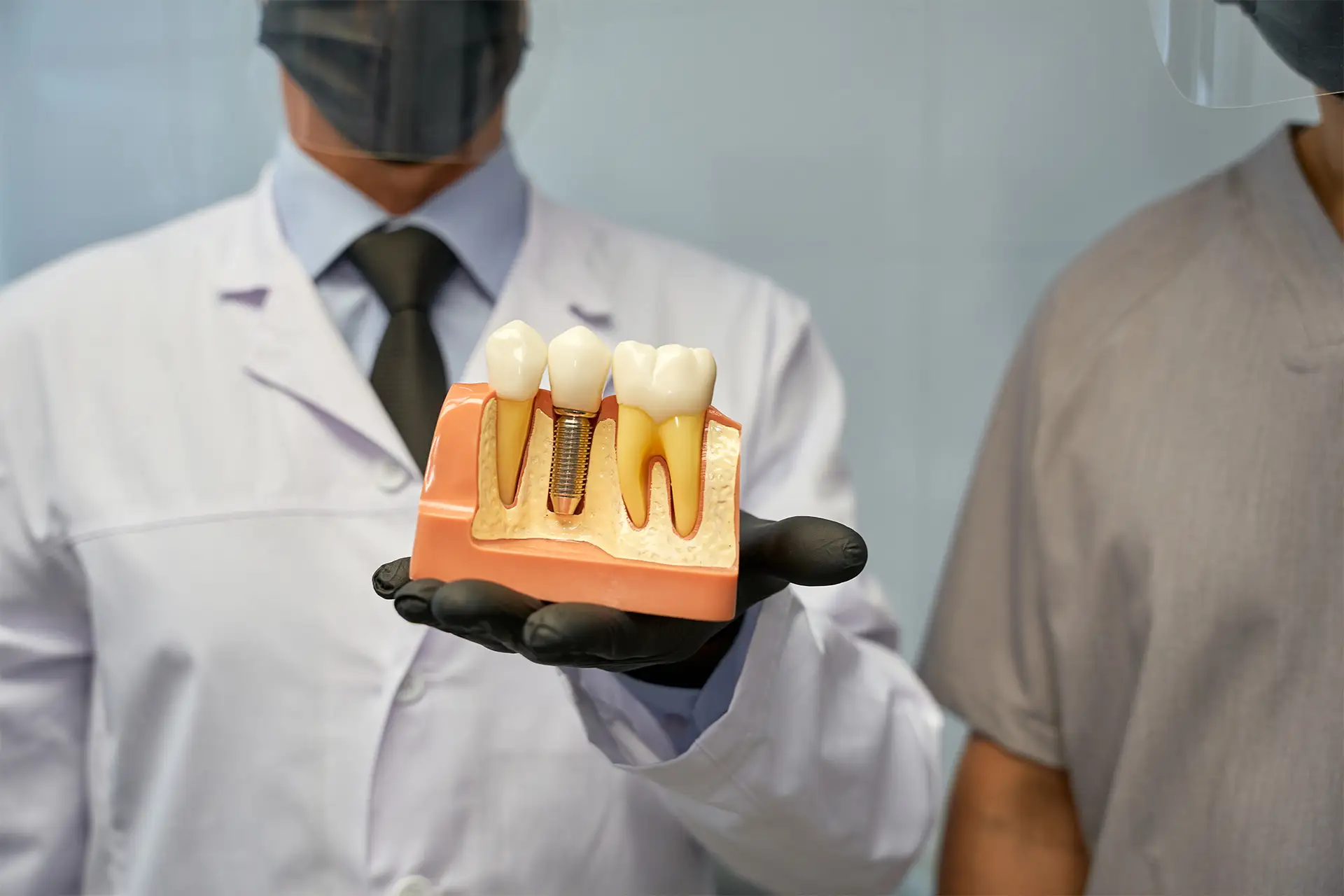 Modello di protesi dentale realizzata nello studio odontoiatrico Maurizio Giussani a Milano