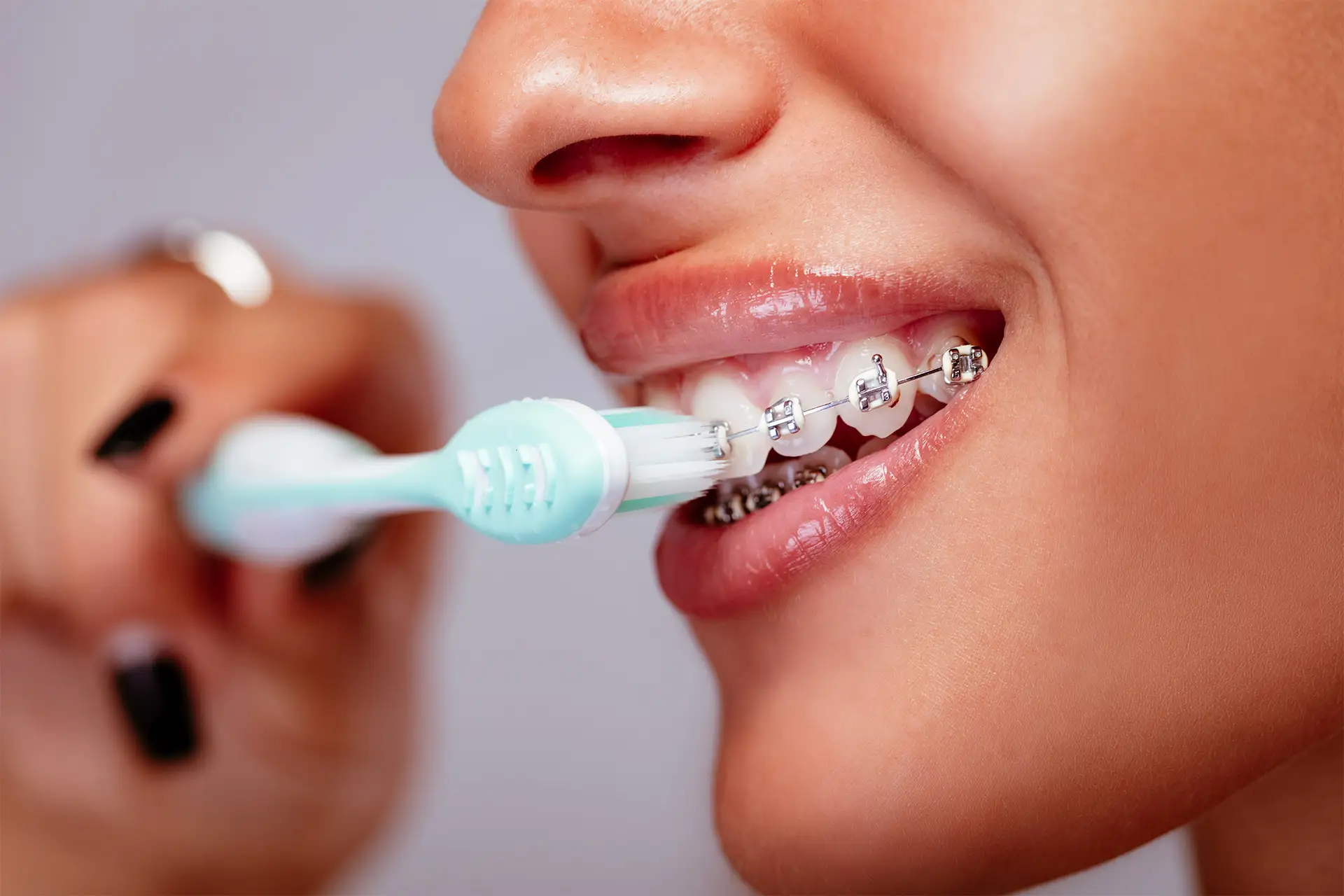 Donna sorridente con apparecchio dentale che si lava i denti dopo aver sostenuto trattamenti odontoiatrici nello studio odontoiatrico Maurizio Giussani a Milano